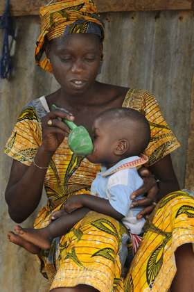 Malnutrition in Mali.