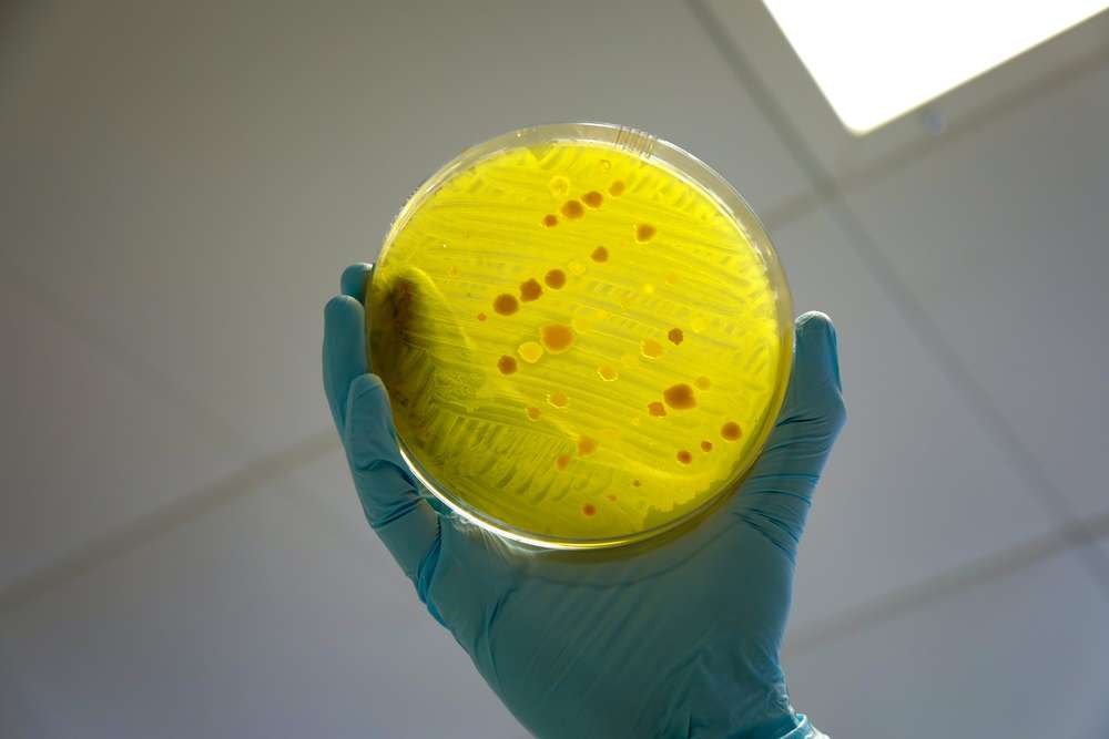 Bagaimana peternakan berkontribusi terhadap resistensi antibiotik global?